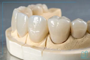 درمانهای نوین دندانپزشکی تحت کانسپت بایومیمتیک