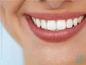 تکنیک‌های جدید در طراحی لبخند