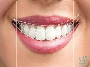 تفاوت لمینت و کامپوزیت