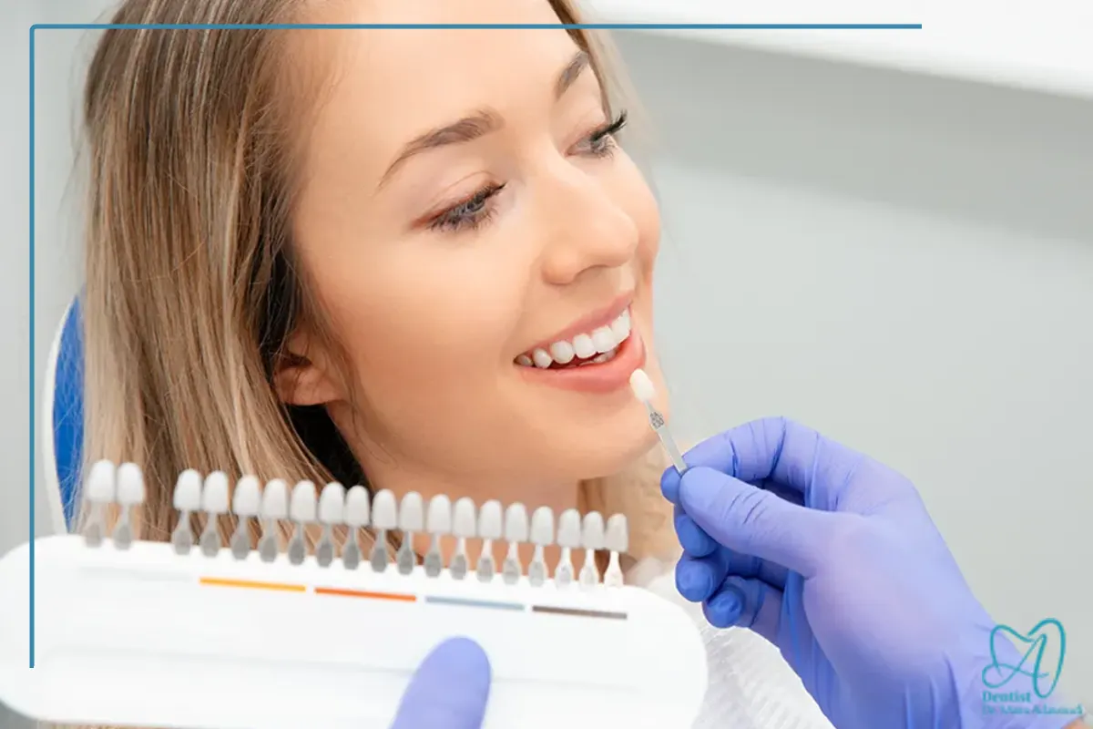 کامپوزیت دندان اصفهان