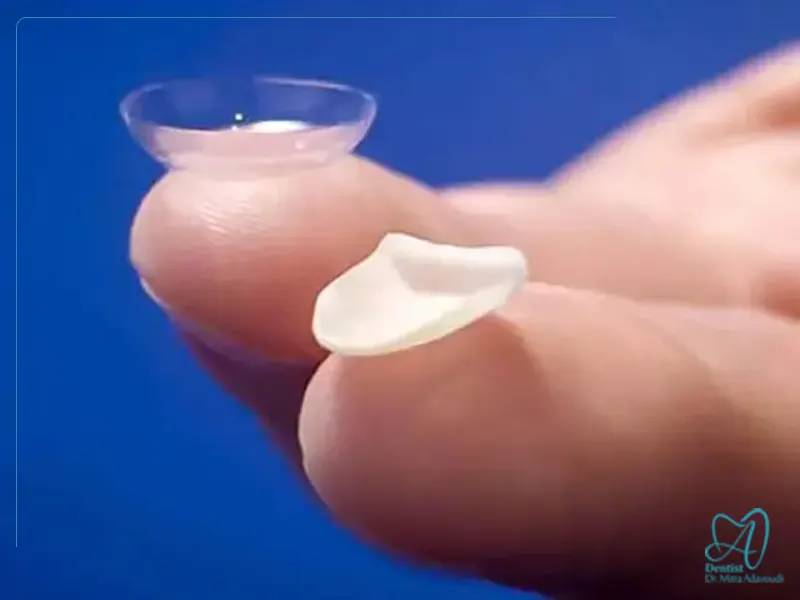 کمترین ضخامت لمینت ممکن چقدر است