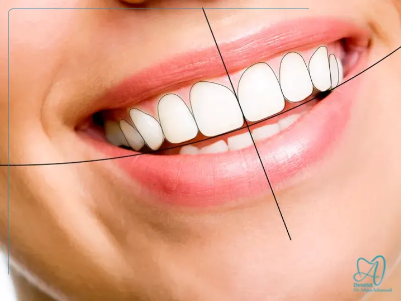 اهمیت تراز لب‌ها در طراحی لبخند