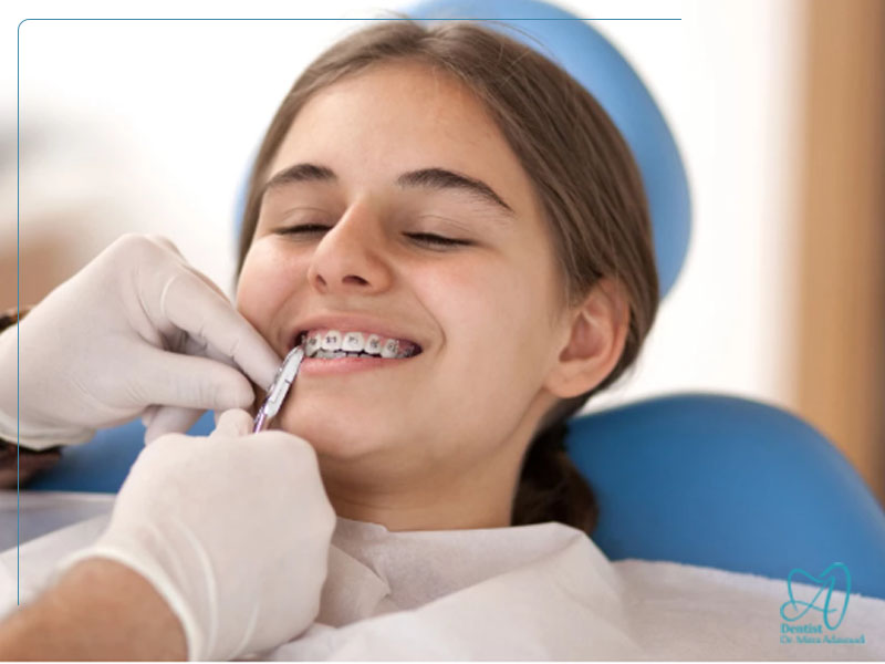 درمان مشکلات فکی با ارتودنسی