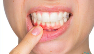 عفونت لثه و خطرات نادیده گرفتن آن