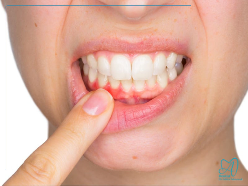 عفونت لثه و خطرات نادیده گرفتن آن